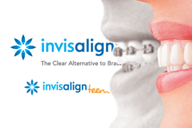 Learn about our invisalign promo